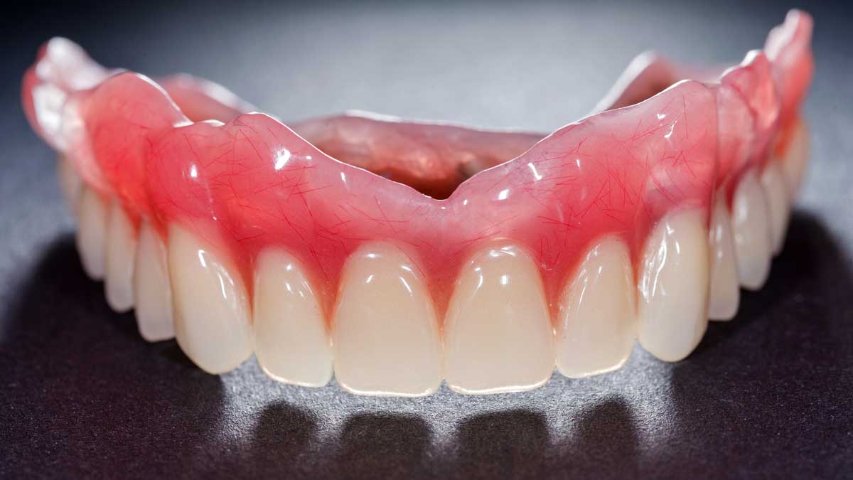 flexible dentures disadvantages