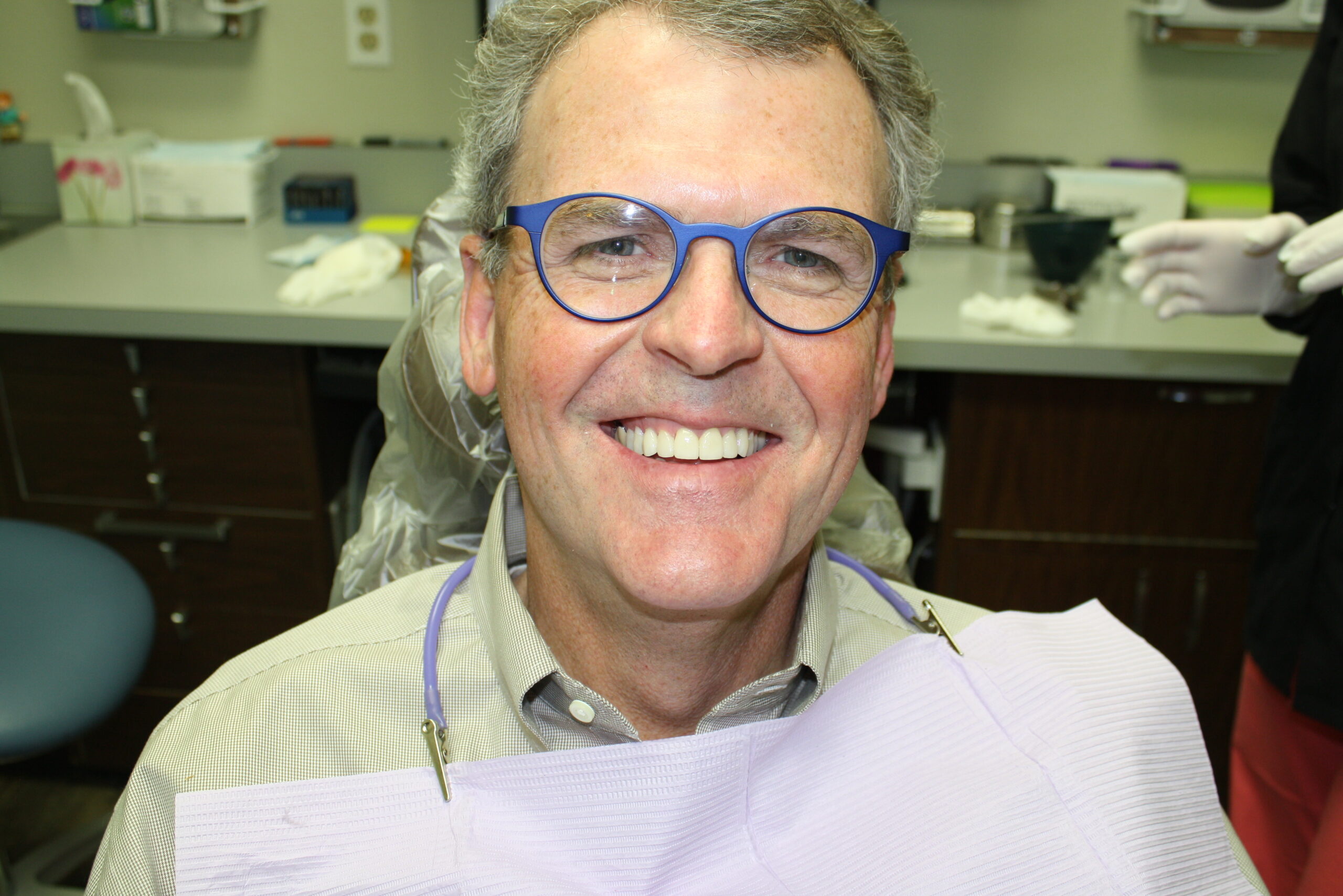 CrownsAndAlignersafter2